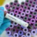 GHS To Aid False COVID-19 Test Results Investigation