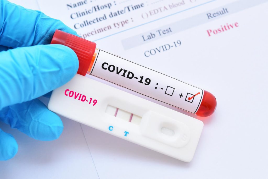 COVID-19: Spread Of New Wave Worrying- Dr.Ofosu