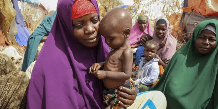 Nunay Mohamed, 25, who fled the drought-stricken Lower Shabelle area, holds her one-year old malnourished child at a makeshift camp for the displaced on the outskirts of Mogadishu, Somalia on June 30, 2022.