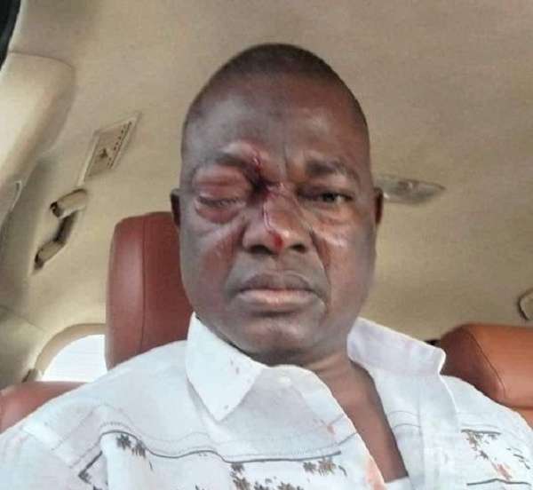 Alan Kyerematen Withdraws from NPP Flag bearer Race, Accuses NPP Executives of Bias Towards Dr Bawumia 2 45113982