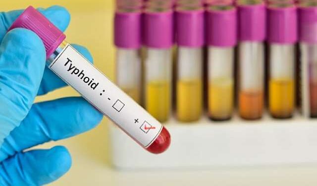 Typhoid Surges in Oti Region