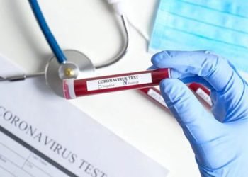 Over 150 Medical Practitioners hit with COVID-19 – GMA