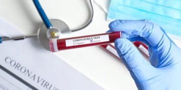 coronavirus 3 620x406 2