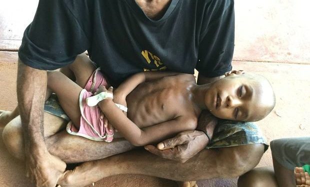 Nearly 9 percent of the world population suffered from hunger in 2019 - FAO 1 eight col Father holds malnourished son Sally Lloyd