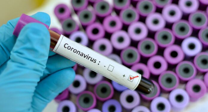 GHS To Aid False COVID-19 Test Results Investigation