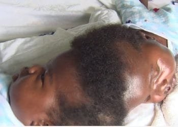 Ghanaian media personality, Nana Aba Anomoah, has received a touching message from the first-ever separated conjoined twins in Ghana over her recent kind gesture.