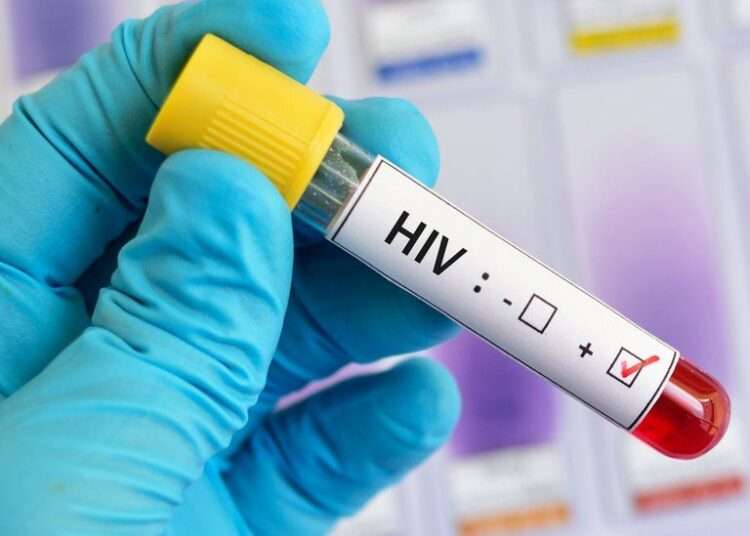 Historic as HIV Cure Finally Gets Tested On Humans