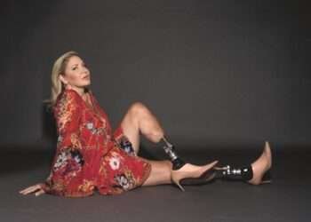 feet being amputated. According to her, she endured an 18-month nightmare when she contracted cerebral malaria from a mosquito bite during a visit to Lagos, Nigeria.