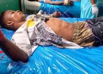 Affected victims of the Apiate explosion receiving treatment