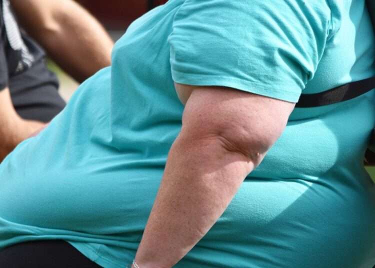 Obesity Rising In Africa, WHO Analysis 1 Obesity Rising In Africa, WHO Analysis