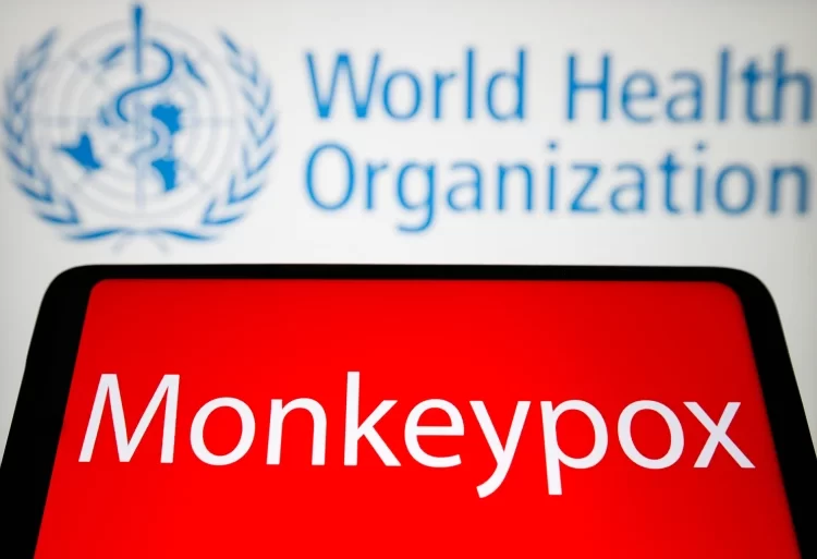 Monkeypox Outbreak: WHO Expects More Cases Globally 1 Monkeypox
