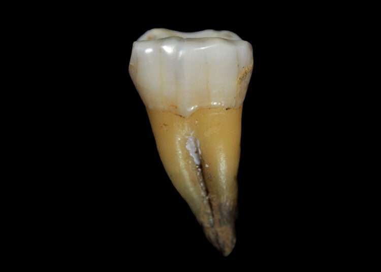 200511 homosapien tooth cs 917a