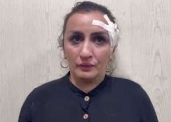 Mother Sells Her Five-Day-Old Baby Boy For £3,000 To Pay For Nose Job 8 An image of the woman who reportedly sold her newborn son to pay for a nose job