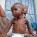 IRC Warns Of Imminent Famine Declaration For Millions In Somalia Due To Extreme Drought