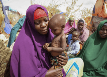 Nunay Mohamed, 25, who fled the drought-stricken Lower Shabelle area, holds her one-year old malnourished child at a makeshift camp for the displaced on the outskirts of Mogadishu, Somalia on June 30, 2022.