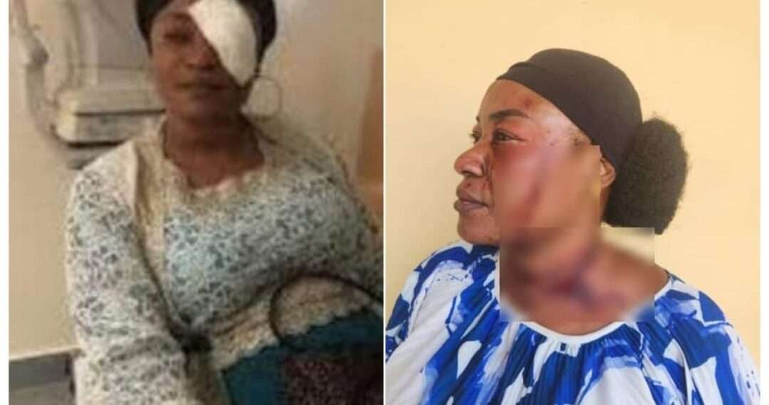 NDC Condemns Assault on Northern Regional Party Treasurer 1 Hajia Shamima Yakubu,