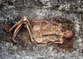 Ancient Skeletons Give Clues To Modern Medical Mysteries