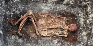 Ancient Skeletons Give Clues To Modern Medical Mysteries