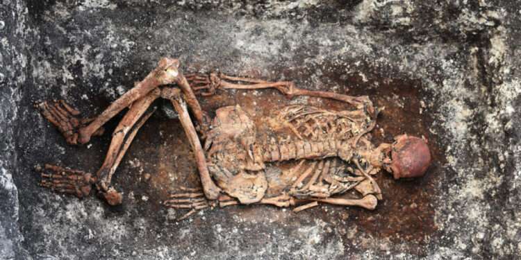 Ancient Skeletons Give Clues To Modern Medical Mysteries 1 Ancient Skeletons Give Clues To Modern Medical Mysteries
