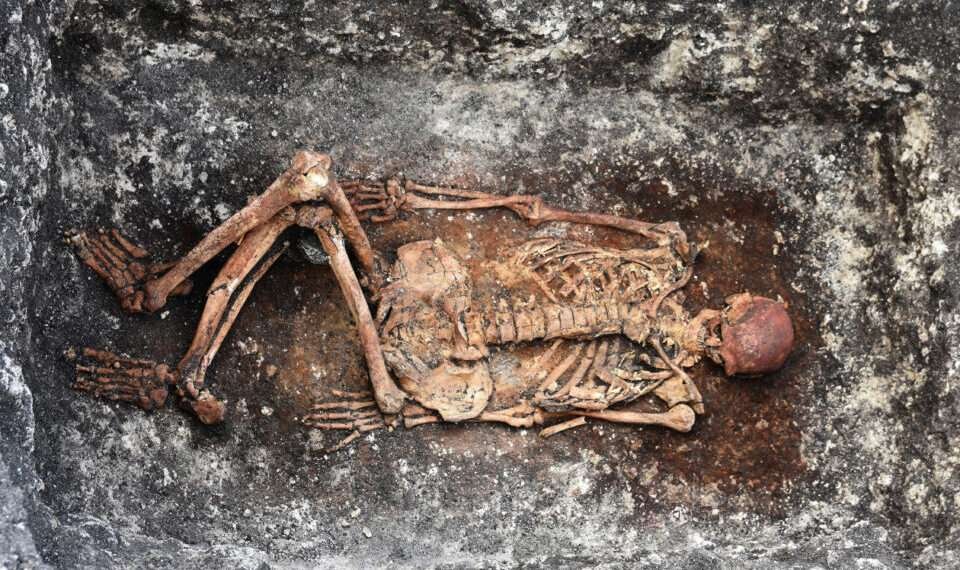 Ancient Skeletons Give Clues To Modern Medical Mysteries