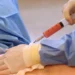 The BBL Craze To Enhance Looks 11 BBL Surgery Procedure