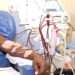 free dialysis treatment by government