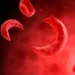 Government Commits to Eradicating Sickle Cell Disease 12 Sickle Cell Disease