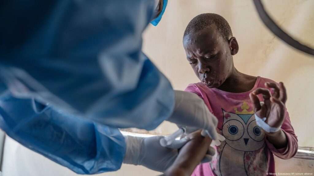 A girl being vaccinated against mpox