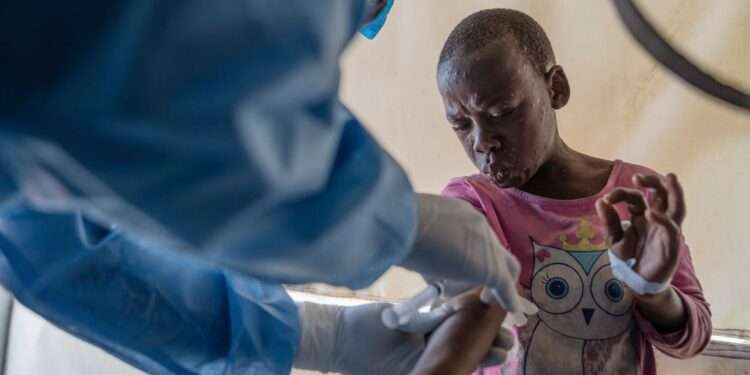 Senegal Confirms First Mpox Case Of 2025