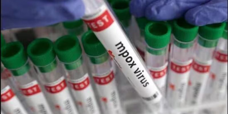Senegal Confirms First Mpox Case Of 2025