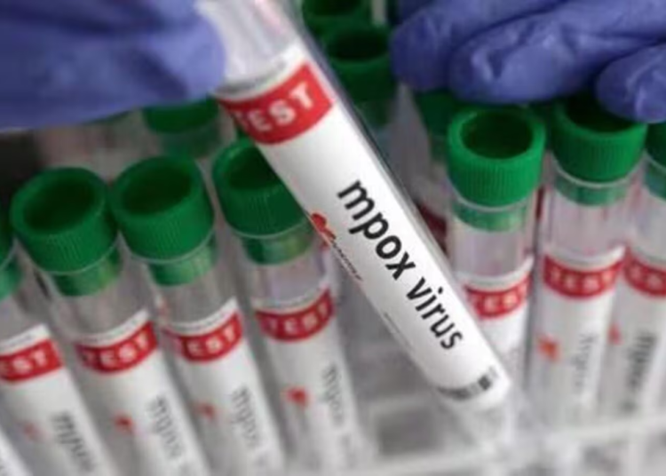 Senegal Confirms First Mpox Case Of 2025