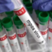 Senegal Confirms First Mpox Case Of 2025