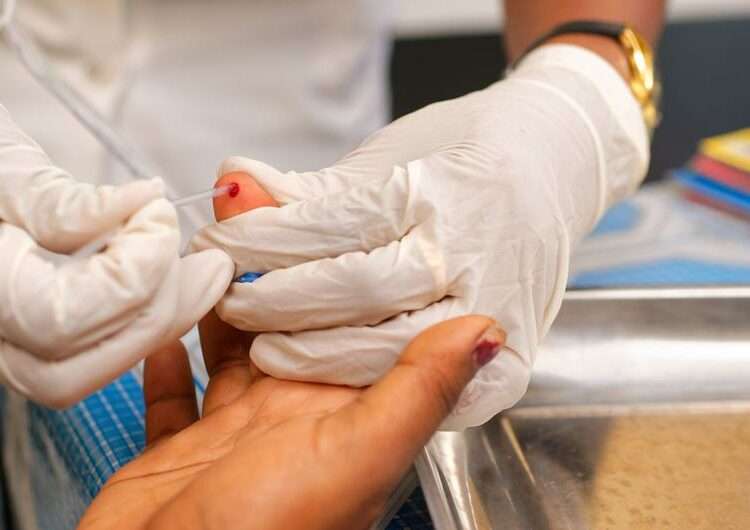 US Aid Freeze Disrupts Global HIV Treatment 1 US Aid Freeze Disrupts Global HIV Treatment