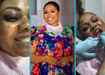 Empress Gifty Shares Cost of Her Composite Veneers
