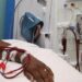 Dialysis Treatment