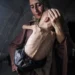 Muhammad Zakariya Ayyoub al-Matouq, an 18-month-old child in Gaza City, Gaza, faces life-threatening malnutrition.