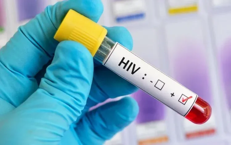 Funding Cuts Threaten Global AIDS Progress Gains 1 Funding Cuts Threaten Global AIDS Progress Gains
