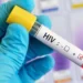 Funding Cuts Threaten Global AIDS Progress Gains 11 Funding Cuts Threaten Global AIDS Progress Gains