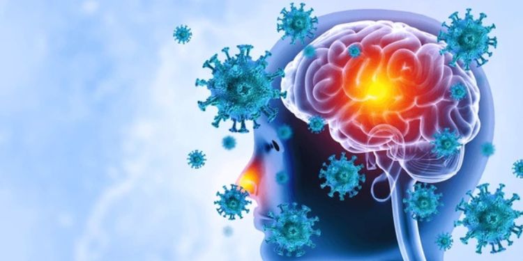 Meningitis Outbreak Sparks Public Health Concern 1 Brain Viral Infection Meningitis