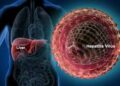 3M Ghanaian Living with Hepatitis, only1% Know Their Status – Dr Adiboka 7 HEPETITIS