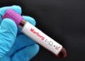 Marburg Virus