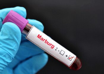 Marburg Virus