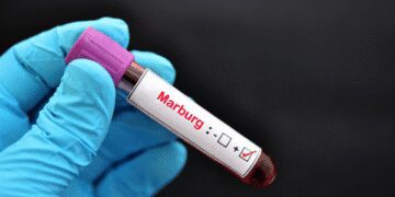 Marburg Virus