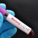 Uganda Confirms Isolated Marburg Case 12 Marburg Virus