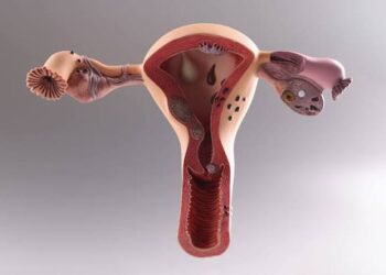 Early PCOS Diagnosis Can Reduce Health Risks for Women - Dr. Eugene 4 PCOS