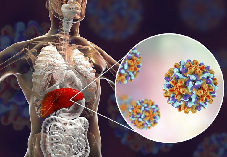 3Million Ghanaians Living with Hepatitis, only 1% Know Their Status – Dr Adiboka 2 image 102