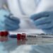DR Congo Secures 70,000 Ebola Vaccine Doses as Outbreak Escalates 15 Bundibugyo Ebola Virus