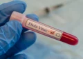Bundibugyo Ebola Virus
