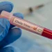 Bundibugyo Ebola Virus
