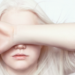 UN Expert Warns Colour Discrimination Harms Persons with Albinism 13 Person with Albinism
